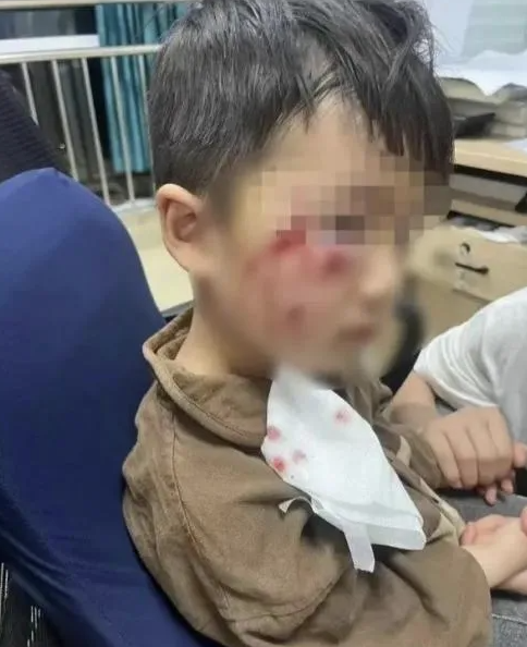 被瘋犬咬傷沒(méi)有“救命藥”，怎么辦？
